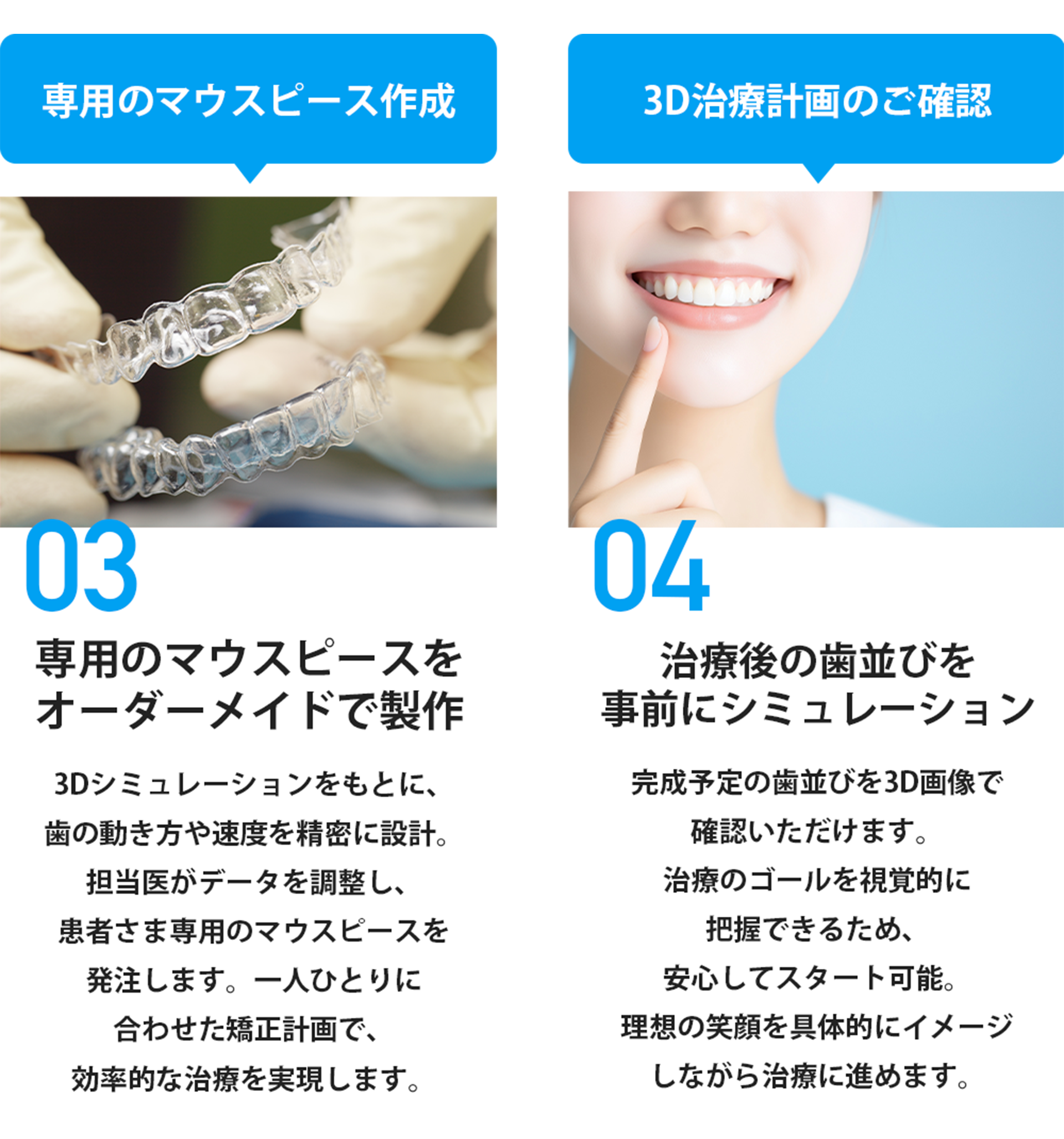 インビザラインの流れ3.4